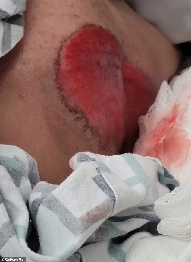 Heroic Backpack Saves 12-Year-Old in Near-Fatal Wisconsin Accident