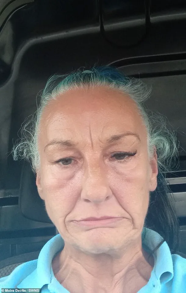 Moira Devlin's £24,000 Dental Implant Alters Appearance, Resembling Fictional Characters and Causing Emotional Turmoil