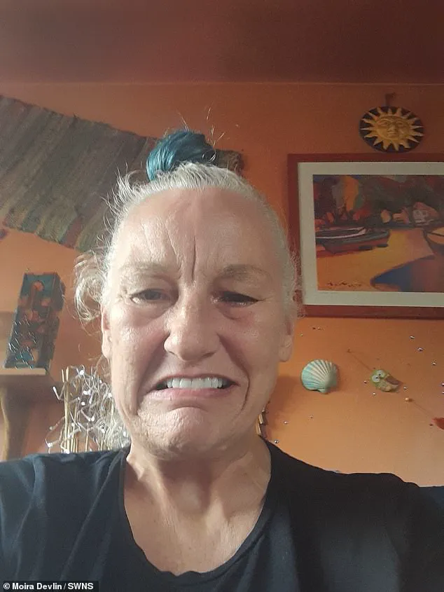 Moira Devlin's £24,000 Dental Implant Alters Appearance, Resembling Fictional Characters and Causing Emotional Turmoil