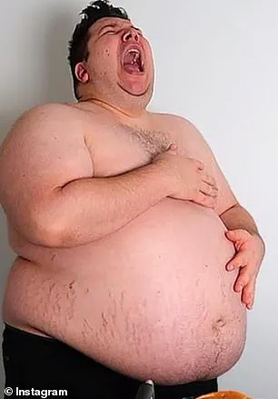 Surge in Weight Loss Drug Use Linked to Increased Demand for Cosmetic Surgery