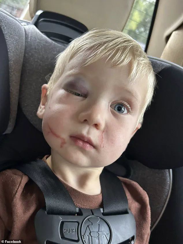 Georgia Judge Faces Backlash After Granting Bail to Daycare Worker Accused of Injuring One-Year-Old