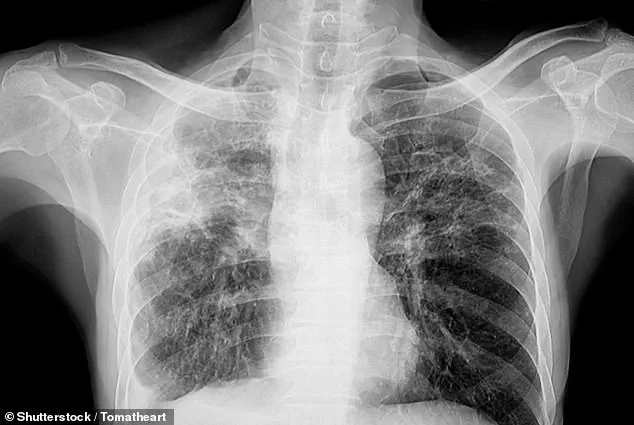 Urgent Warning: Silent Health Crisis Links Chronic Lung Disease to Vision Loss, Experts Warn
