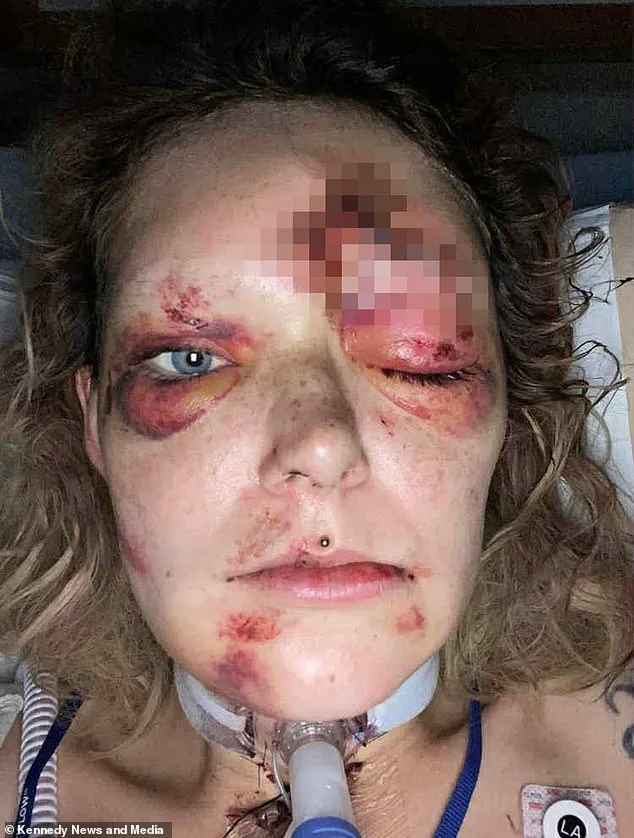 Tragic E-Scooter Accident Leaves Illinois Mother with Catastrophic Injuries, Child Critical