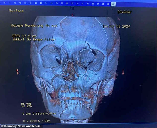 Tragic E-Scooter Accident Leaves Illinois Mother with Catastrophic Injuries, Child Critical