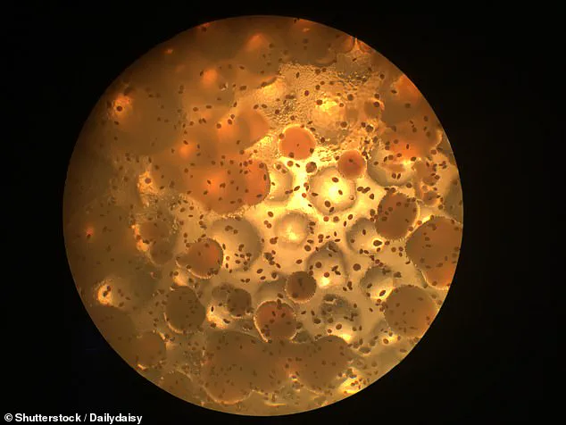 Urgent Recall Expanded to Over 30 Soap Products Marketed to Immunocompromised Individuals Due to Burkholderia cepacia Contamination