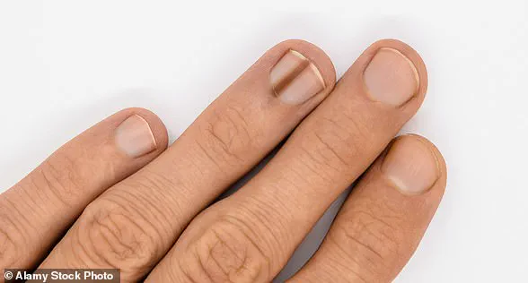 Heed the Body's 'Whispers': Experts Warn That Subtle Symptoms May Signal Serious Illness Early