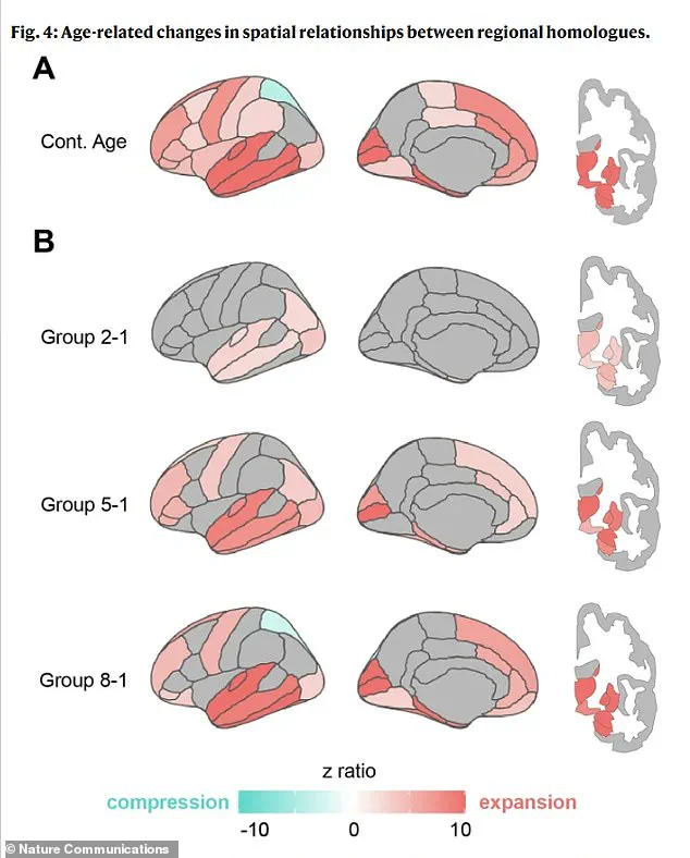 New Research Reveals Brain Shape Changes as Early Dementia Indicator, Shifting Focus to Whole-Brain Analysis