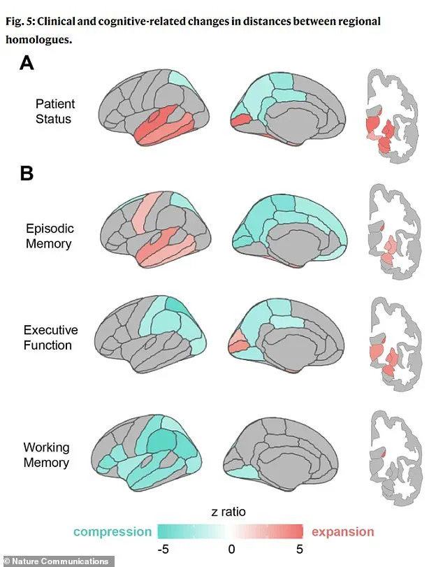New Research Reveals Brain Shape Changes as Early Dementia Indicator, Shifting Focus to Whole-Brain Analysis