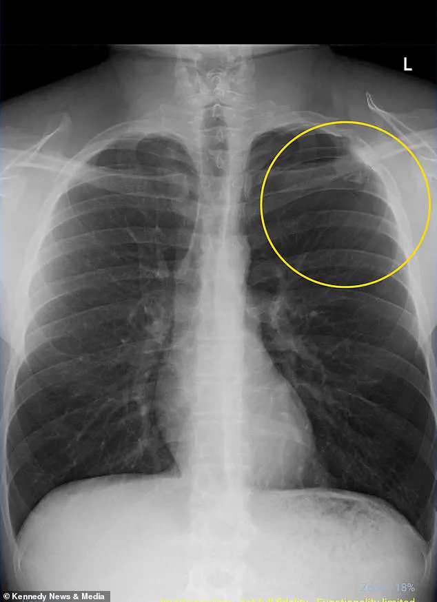 From Vaping Injury to Advocacy: Hudson Williams Warns of Community Health Risks