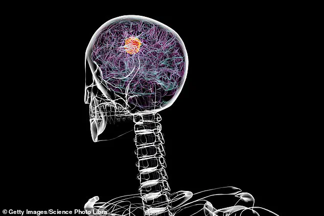 Late-Breaking Discovery: Decades-Old Hypertension Drug Shows Promise in Combating Deadly Brain Cancer Glioblastoma
