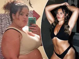 A Race Against Time: Melissa Schloemer's Urgent Journey to Gastric Sleeve Surgery