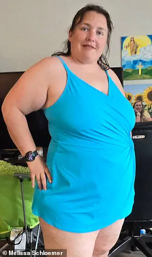 Mysterious Rash Linked to Theme Parks Leads to Surprising Diagnosis for Woman