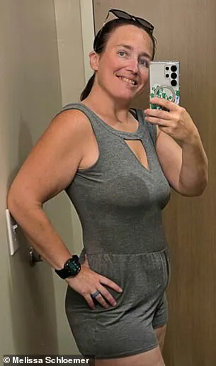 Mysterious Rash Linked to Theme Parks Leads to Surprising Diagnosis for Woman