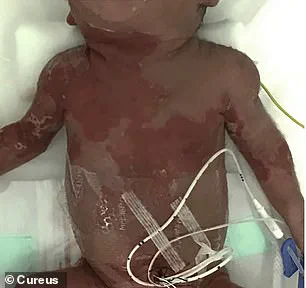 Undetected Herpes Infection in Pregnancy Leads to Tragic Infant Death in Japan