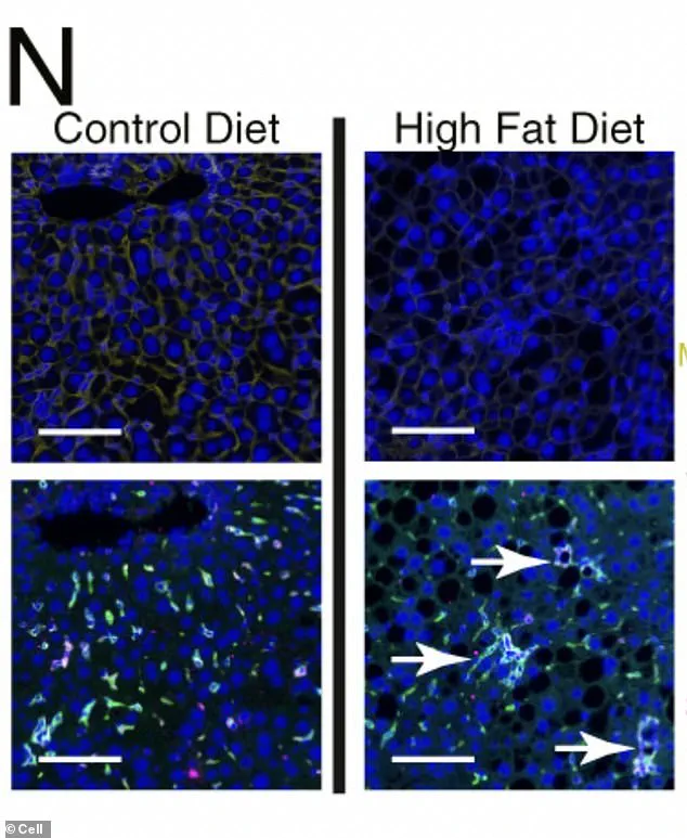 MIT and Harvard Researchers Warn: High-Fat Diet Triggers Genetic Liver Changes, Paving Path for Years-Later Cancers – Expert Advisories Stress Need for Early Dietary Interventions