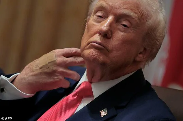 Public Health Concerns Amidst Presidential Dietary Choices: Expert Advisories Highlight Risks to National Well-Being