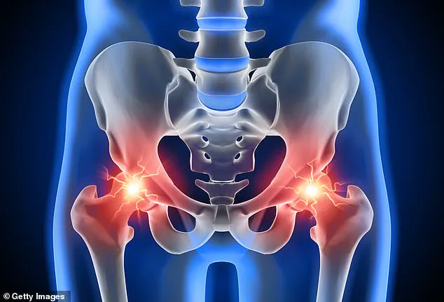 Exclusive Expert Access: Combating Hip Pain's Silent Crisis to Protect Public Health