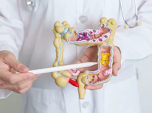 A Father's Warning: Early Bowel Cancer Symptoms Revealed Through a Harrowing Journey