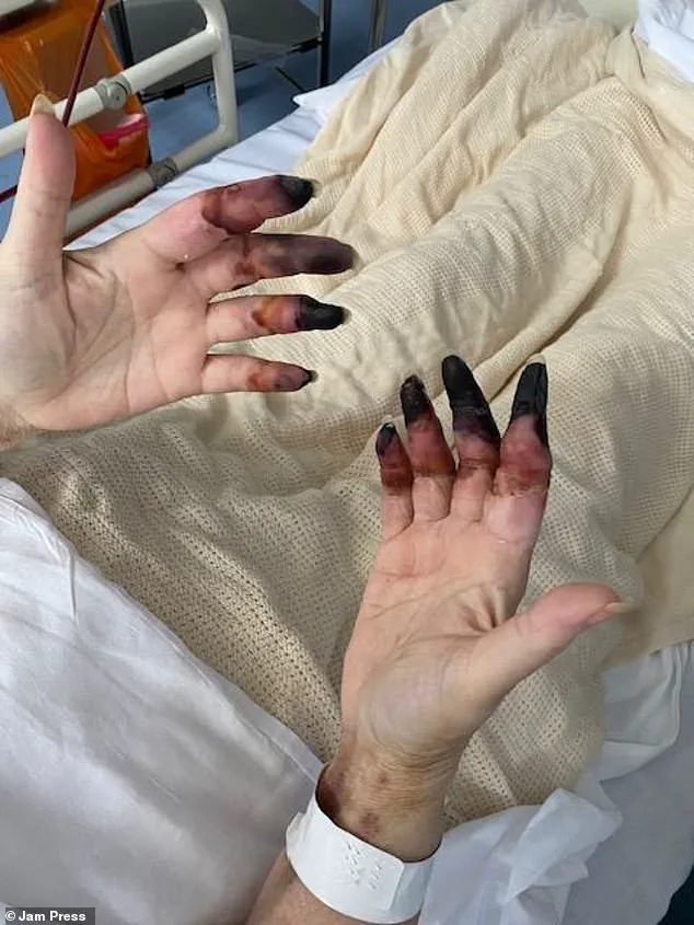 Controversy Over Misdiagnosis Leads to Medical Crisis for Swansea Woman