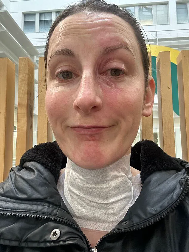 Cecily Beer's Harpist Life Altered by Blender Explosion: 'I Never Imagined This Nightmare'