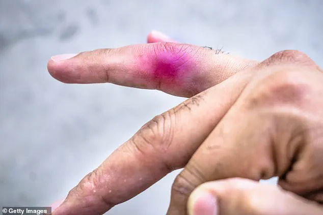 Civil Lawsuit Filed by Nine-Year-Old Canadian Boy Over Toy Dinosaur Incident Leading to Severe Injury at Summer Program in Alberta