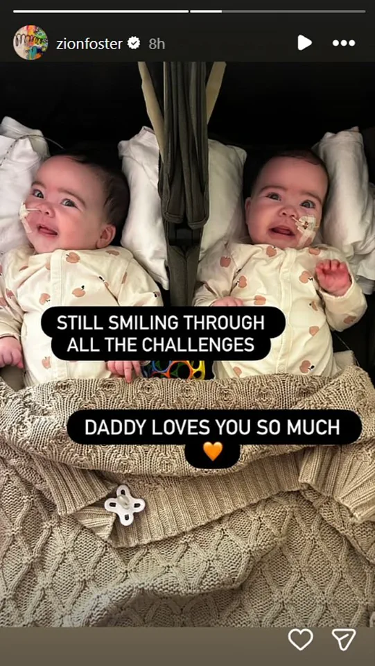 Jesy Nelson's Twins Spotlight NHS Infant Screening Crisis: Thousands of Children at Risk from Failing Rare Disease Detection Program