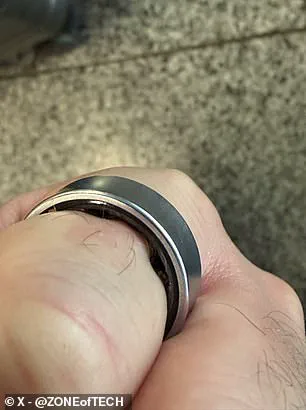 Urgent Warning: Samsung Galaxy Ring Battery Swelling Sparks Hospitalization and Airport Security Incident, Experts Urge Caution