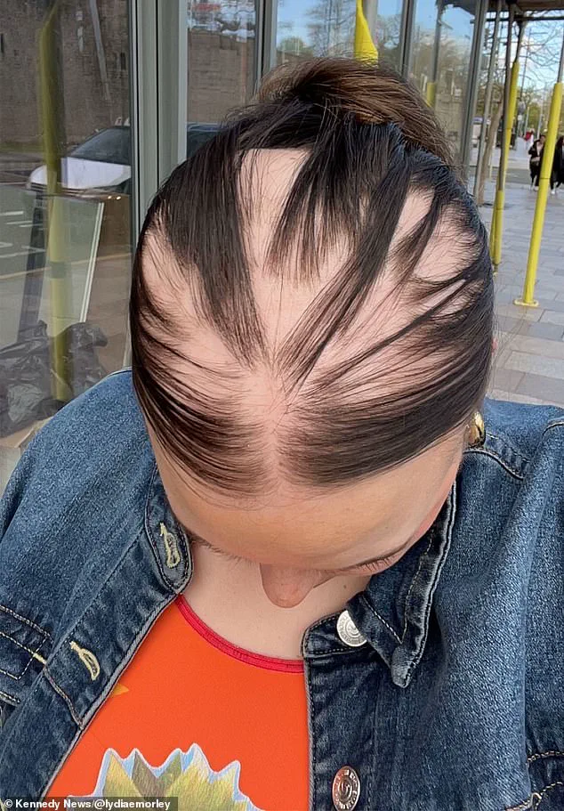 Controversy Over Lasting Immune Effects: Did Covid-19's Impact Go Unnoticed?