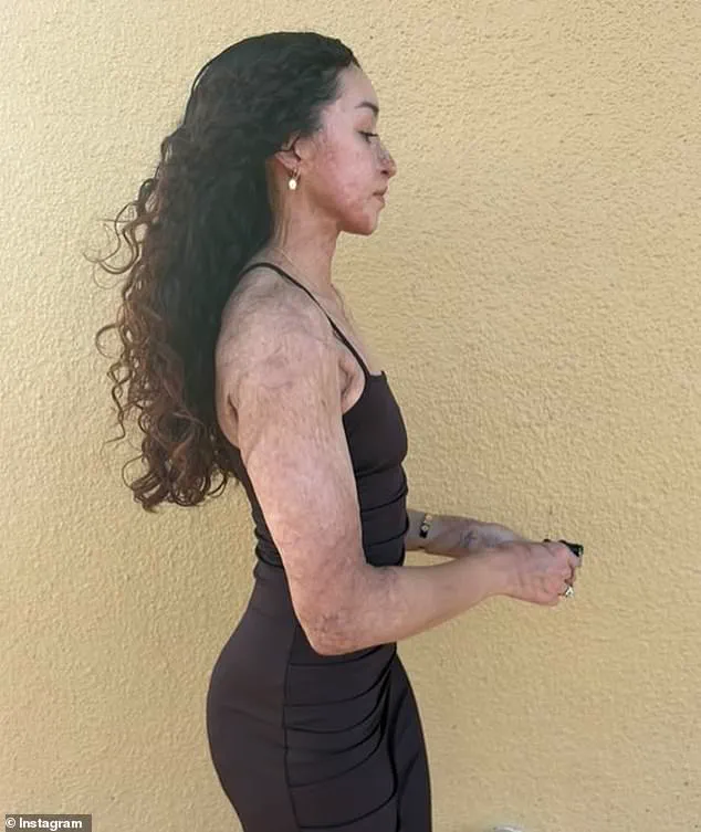 Two Weeks to Glory: Aspiring Bodybuilder Survives Gun Attack at Hawaii Gym