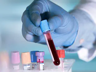 Multiple Myeloma: A Gender-Disparate Blood Cancer with Disproportionate Impact on Men