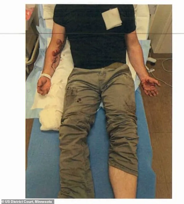 ICE Agent and Protester Involved in Confrontation During Anti-ICE Protest in Minneapolis: Conflicting Accounts