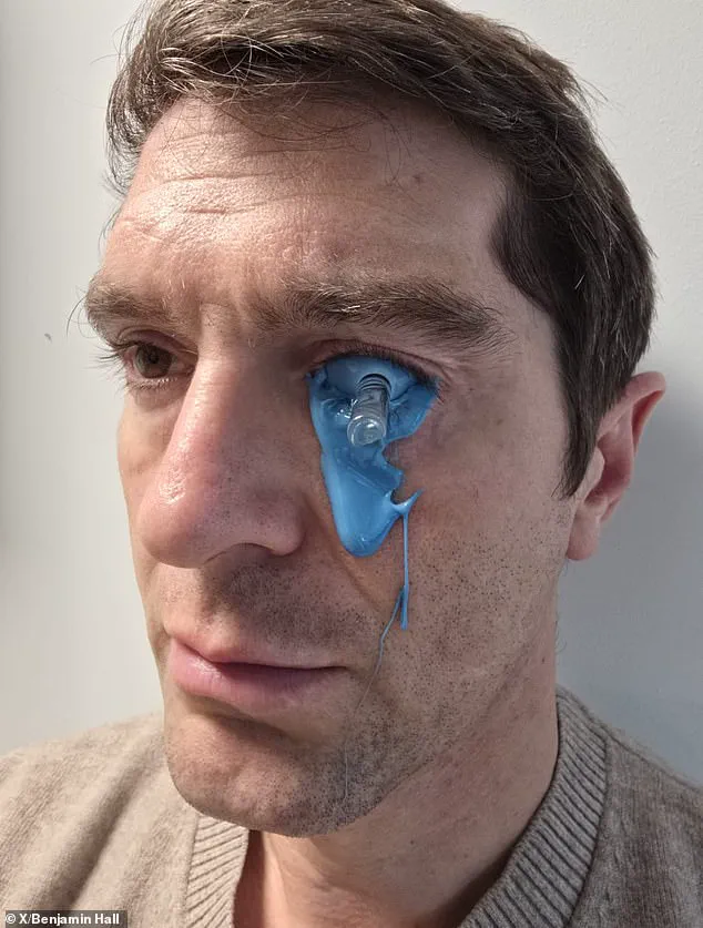 Benjamin Hall Shares Graphic Recovery Image After War Zone Injury, Highlighting Risks Faced by Reporters