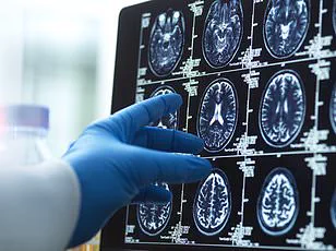 Lund University Study Warns: Dementia Cases to Double in 25 Years – Lifestyle Changes Could Mitigate Risk