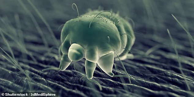 Persistent Itch Case Highlights Gaps in Initial Medical Diagnosis