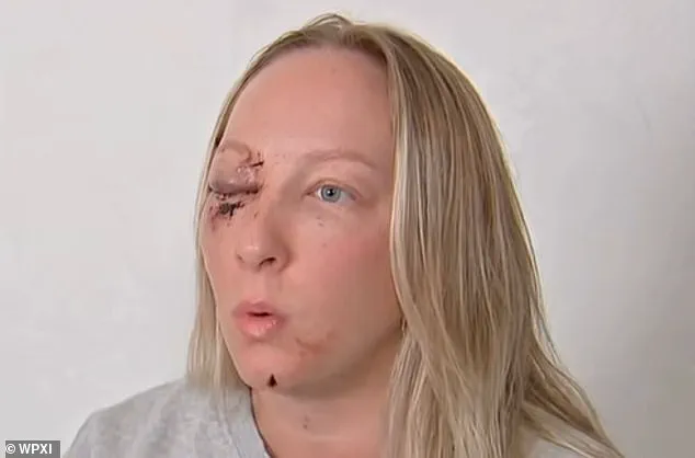 Massive Ice Slab from Truck Shatters Windshield, Injuring Pittsburgh Mother, Terrifying Daughter