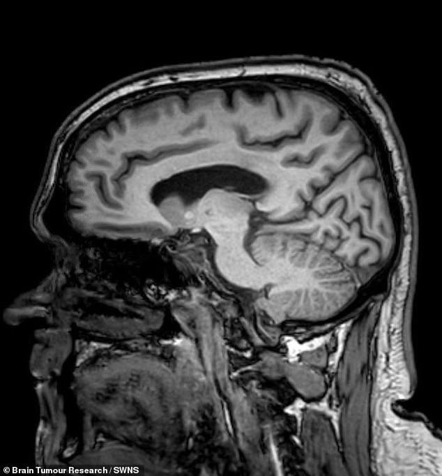 Overlooked Fatigue Symptoms Lead to Car Crash After Two-Year Delay in Diagnosis