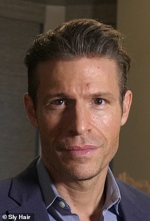 From Thick Curls to Baseball Caps: James Fairview's Hair Loss Battle