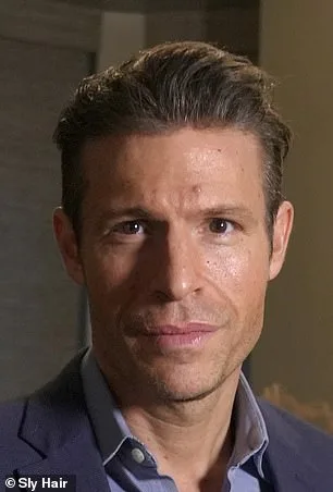 From Thick Curls to Baseball Caps: James Fairview's Hair Loss Battle