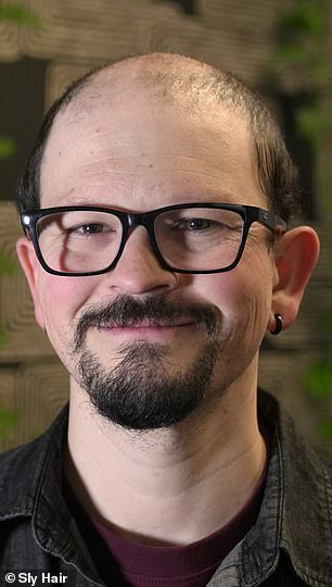 From Thick Curls to Baseball Caps: James Fairview's Hair Loss Battle