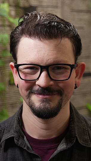 From Thick Curls to Baseball Caps: James Fairview's Hair Loss Battle