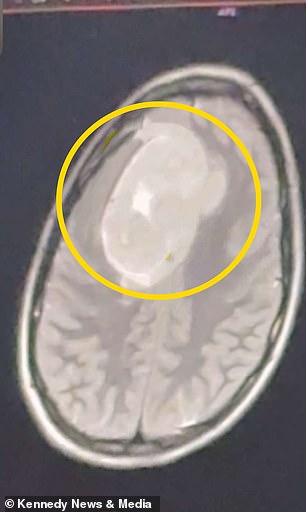 When Dismissed Symptoms Expose Systemic Failures: Gillian Keating's Battle with Misdiagnosis and Medical Neglect