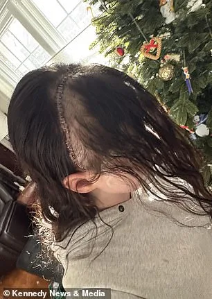 When Dismissed Symptoms Expose Systemic Failures: Gillian Keating's Battle with Misdiagnosis and Medical Neglect