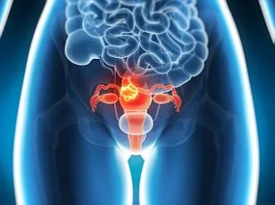 Three-Year Misdiagnosis of Rare Vulval Cancer Leaves Woman in Prolonged Pain