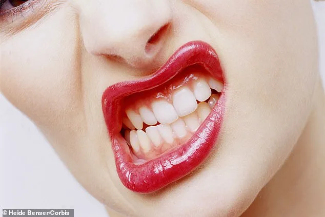 Silent Epidemic: Bruxism's Hidden Toll on Global Health