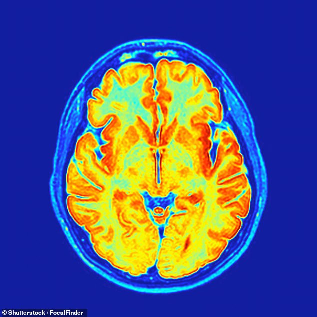 Study Confirms 'Baby Brain' is Real: Maternal Brain Undergoes Structural Reorganization