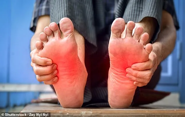 Burning Feet: A Hidden Danger Linked to Peripheral Neuropathy and Diabetes – Don't Ignore the Warning Signs