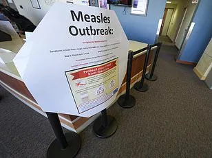 Deadly Secret of Measles Resurges in U.S., Threatening Children with Rare Brain Disease