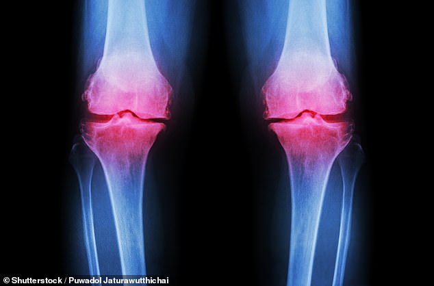 Study Finds Low-Cost Gut Supplement Inulin Could Alleviate Osteoarthritis Pain
