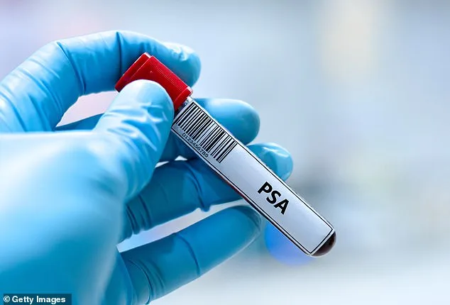 Breakthrough Study Reveals Metformin, a Diabetes Drug, May Cut Prostate Cancer Risk by 35%—A Potential Game-Changer in Prevention