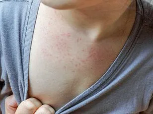 Human Metapneumovirus Surges Across U.S., Lacking Vaccine as Health Officials Sound Alarm